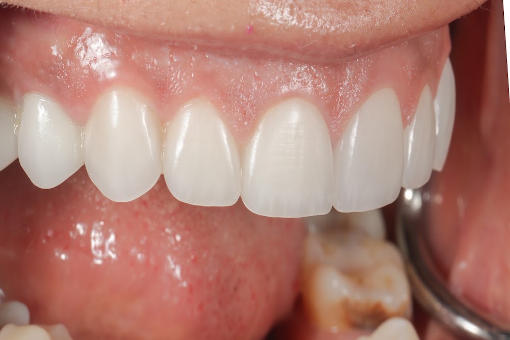 Advanced Dentistry of Chicago | Stuart Schelkopf DDS. MS. FACP