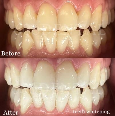 606 Dental